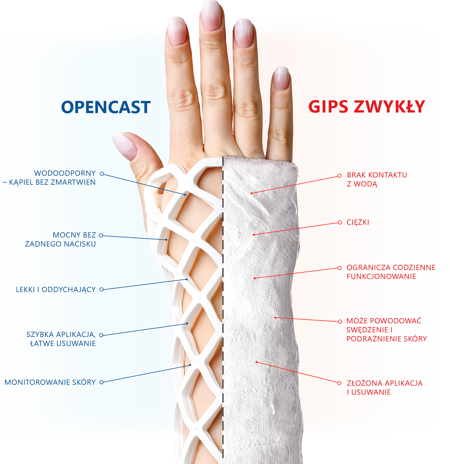 Běžná sádra vs OPEN CAST